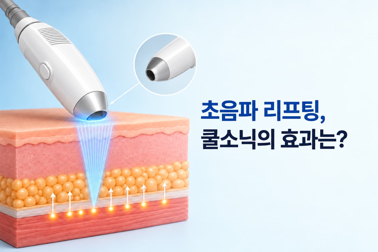 초음파 리프팅은 어떤 원리일까_쿨소닉의 냉각 기술과 효과