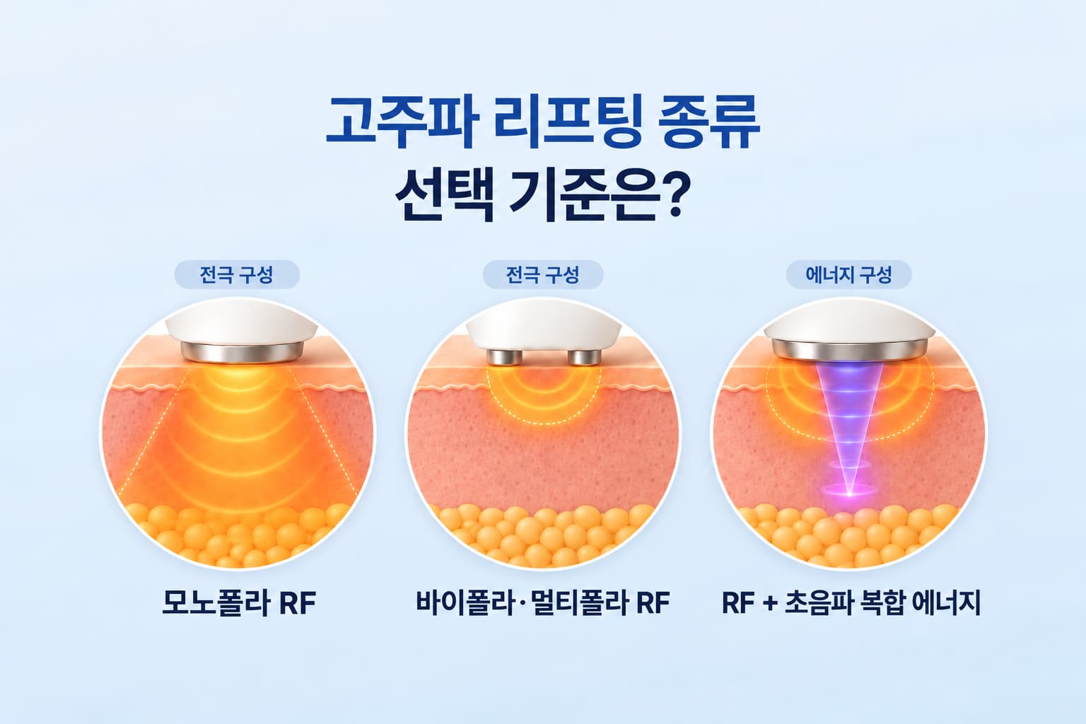 고주파_리프팅_종류는_장비별_차이와_피부_고민별_선택_기준