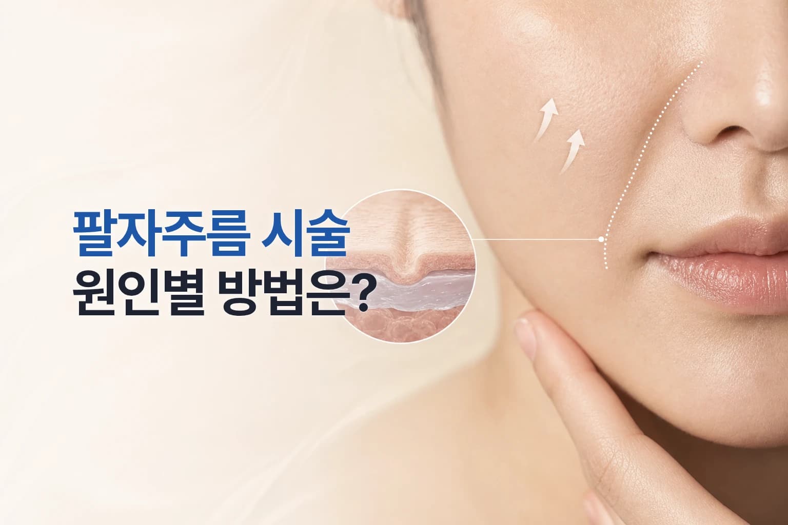 팔자주름 시술로 개선 가능한 범위는_필러_리프팅 효과와 유지기간