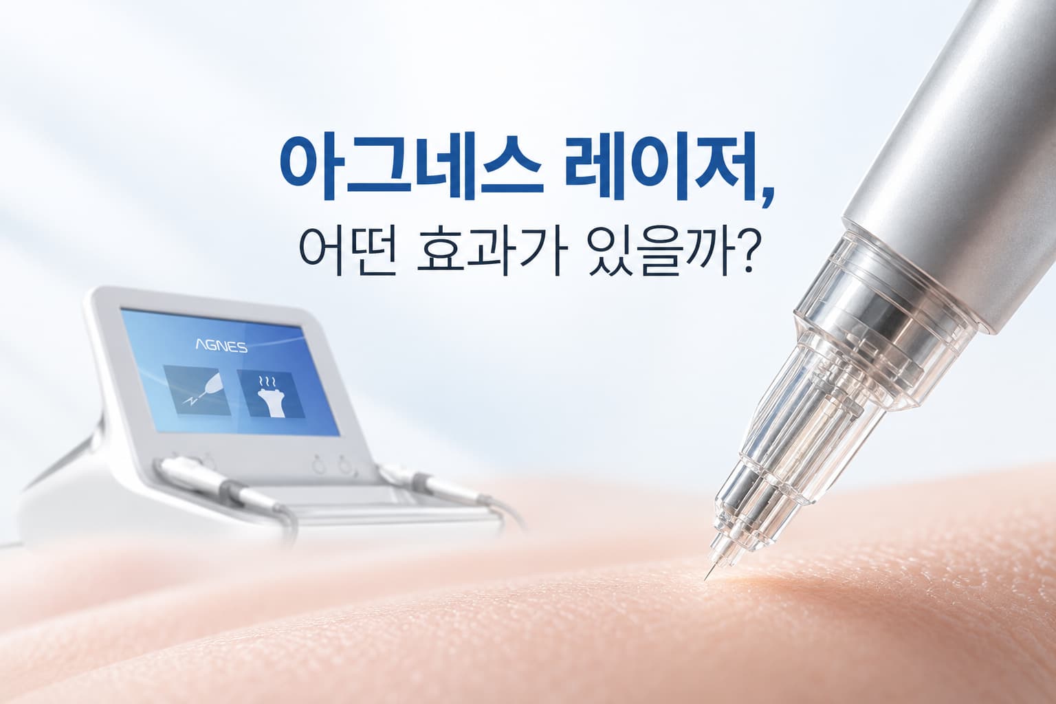 아그네스 레이저 효과는_미세절연침 고주파 원리와 작용 방식 정리